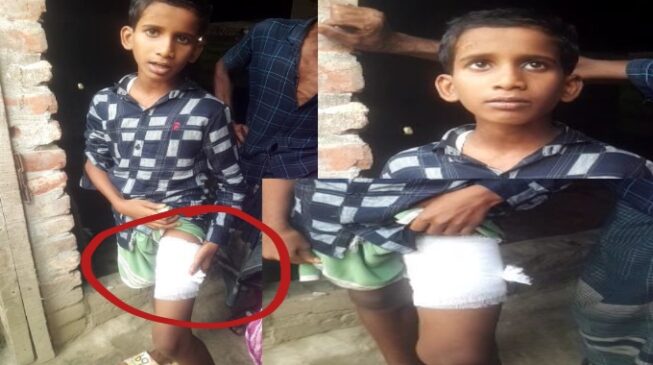 অভিযোগ উঠেছে ওই প্রধান শিক্ষকের মারধরের কারণে ভর্তি হতে হয়েছে মেডিকেলে। পরে অপারেশন করে বেশ কিছু দিন চিকিৎসা নিয়ে বাসায় ফিরেছে.... আরো বিস্তারিত পড়ুন