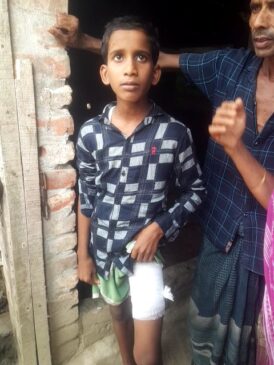 আহত শিশু রিদয় হোসেন 