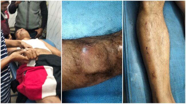 বাগমারায় নৌকার সমর্থককে পেটানোর অভিযোগ স্বতন্ত্র প্রার্থীর সমর্থকের উপর