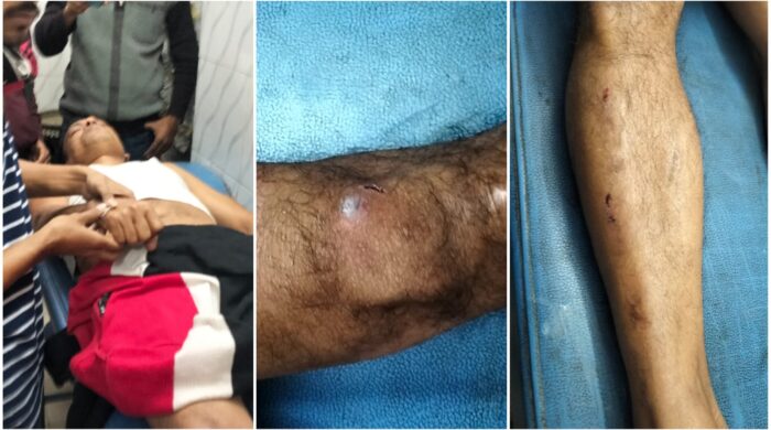 বাগমারায় নৌকার সমর্থককে পেটানোর অভিযোগ স্বতন্ত্র প্রার্থীর সমর্থকের উপর