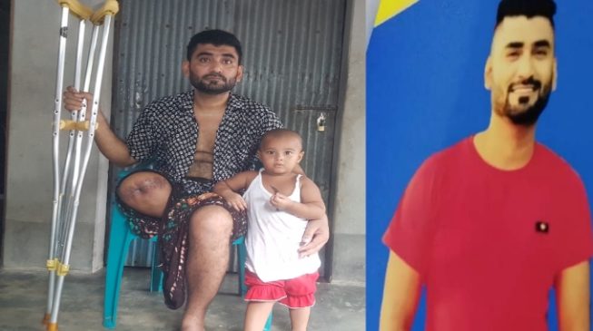 পুলিশের গুলিতে পা হারানো পুঠিয়ার ইমরানের অর্থাভাবে চিকিৎসা বন্ধ! সংসারও চলছে টেনেটুনে
